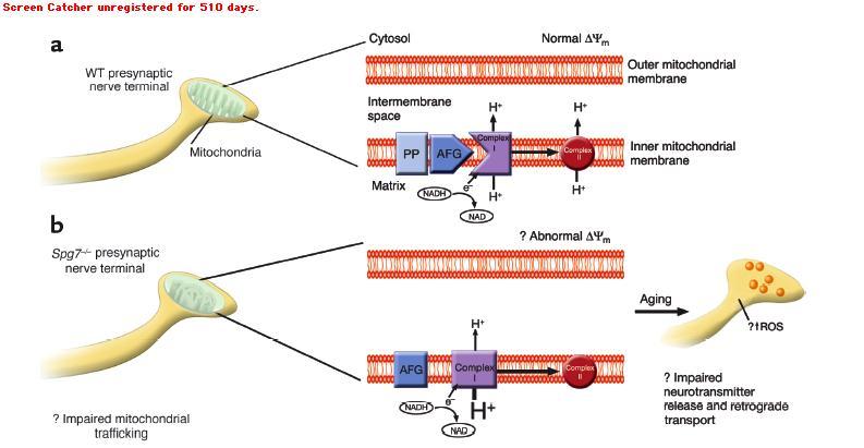paraplegin Hypothetical mitochondrial model energy-dependent for diminished protease Complex I activity Paraplegin-deficient mice display in