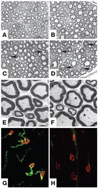 mitochondrial morphology in the peripheral nerves of paraplegin-deficient