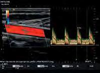 cardiaco, per una migliore osservazione del cuore