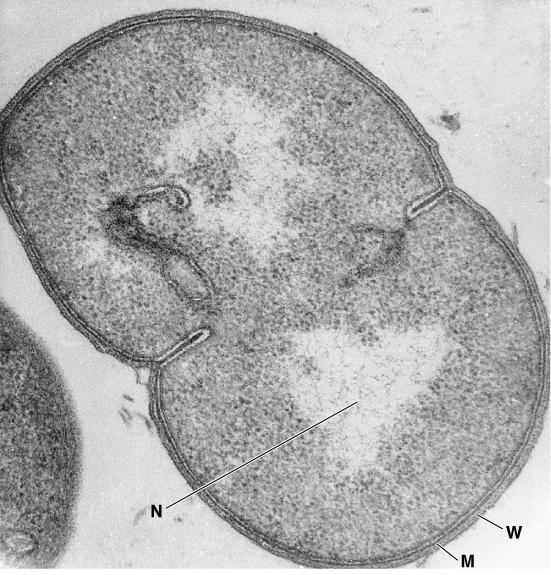 Sezioni trasversali (TEM) di un procariote