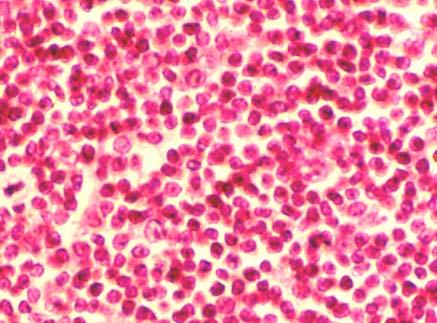 tessuto linfoide in esso prevale la componente cellulare (linfociti) costituisce gli