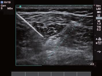 Alcuni algoritmi proprietari ottimizzano i vari parametri di imaging consentendo la produzione di dati essenziali in modo semplice e rapido.