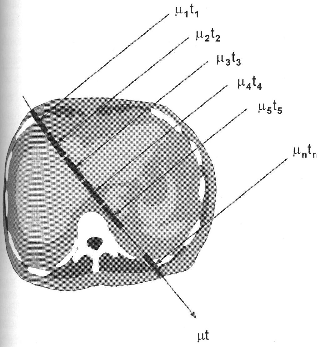 PREPROCESSING Per ogni raggio misurato, µ è determinato dalla composizione e dalla densità dei tessuti attraversati linearmente µt = µt1 + µt2 +.