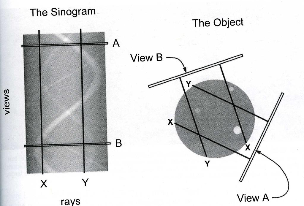 PREPROCESSING SINOGRAMMA E la rappresentazione dei dati grezzi prima della ricostruzione dell