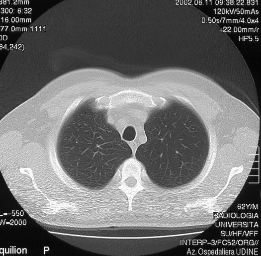 Prima metodica di Imaging