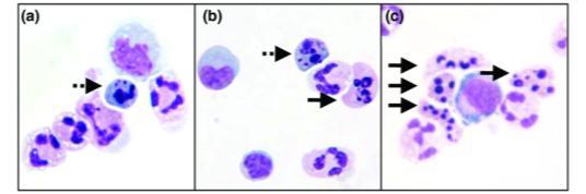 Nuclei di linfociti normali o apoptotici Segnali di fluorescenza Sono dovuti : 1) a molecole fluorescenti presenti nelle cellule (fluorescenza intrinseca) 2)