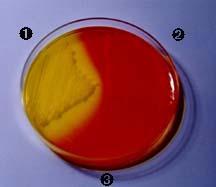 TERRENI DI COLTURA Terreni differenziali Mannitol Salt Agar (agar sale-mannite, Chapman agar): terreno selettivo (per gli stafilococchi) e