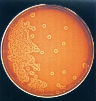 Da: Microbiologia