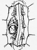 MIELORADICOLOPATIE