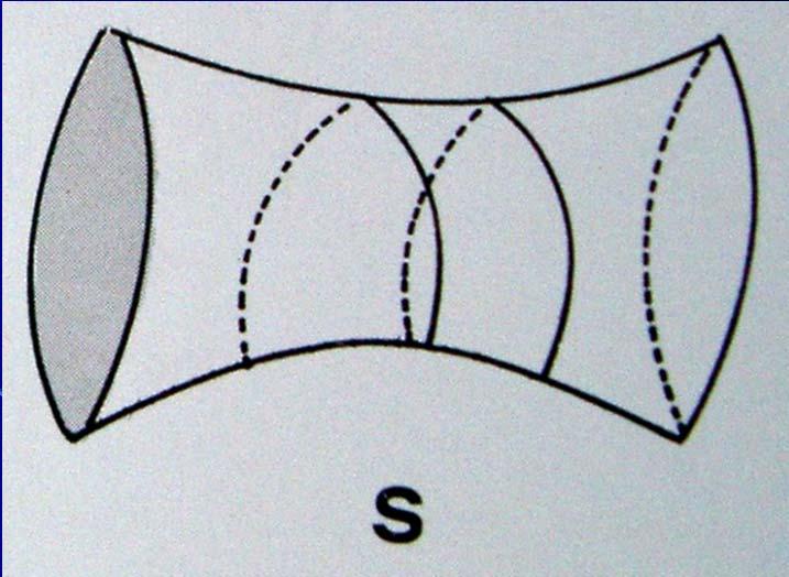 Superfici sellari Concave su un piano e convesse sul piano ortogonale Sono ad