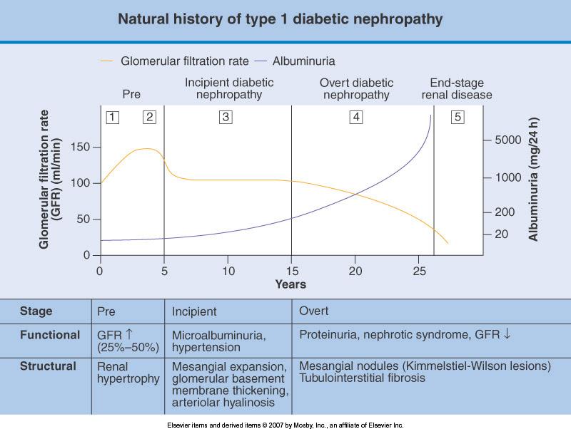 Stadi evolutivi della nefropatia diabetica 1. iperfiltrazione (reni grandi, + frequente nel tipo I) 2. microalbuminuria 3.