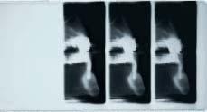 Le proiezioni di Orthoralix 9200, soddisfano le esigenze di routine della pratica odontoiatrica e qualsiasi necessità più complessa di indagine, offrendo la più ampia latitudine diagnostica.