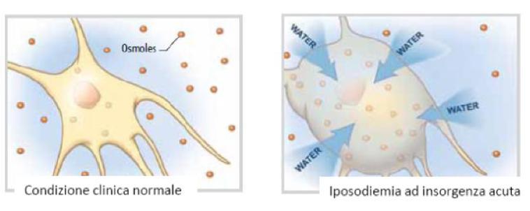 Stress Osmotico della Cellula Cerebrale Glutamin e