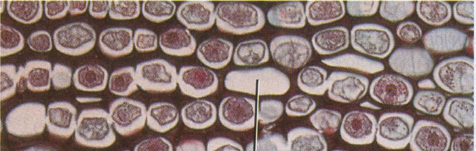 cellule collenchimatiche Il