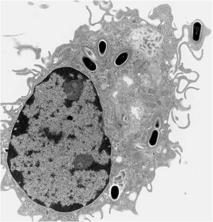 infettivi Macrofagi  infettivi e