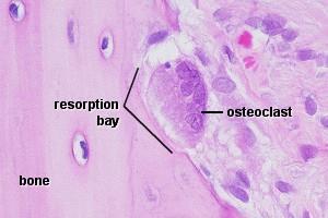 Osteoclasti Digeriscono osso Cellule giganti derivanti