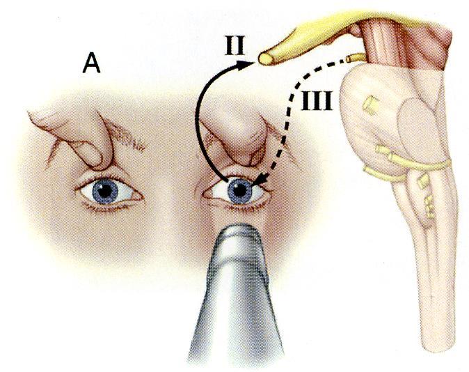 VALUTAZIONE NEUROFISIOLOGICA 6 hs 12 24 hs 72 hs hs EEG