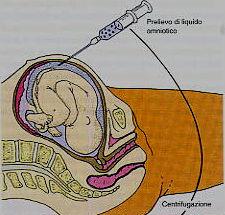 Test di paternità/maternità o parentela Il profilo genetico è costante per ogni individuo dall epoca del concepimento a dopo la morte. Per esempio: Si potrebbero fare test di paternità in utero.