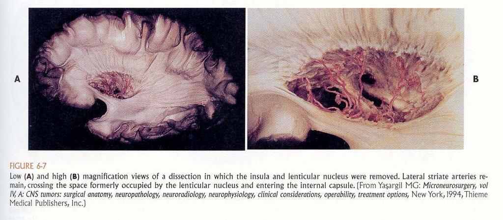 Le vaste ramificazioni superficiali dell arteria cerebrale anteriore riforniscono la corteccia e la sostanza bianca del lobo frontale inferiore, la superficie mesiale dei lobi frontale e parietale, e
