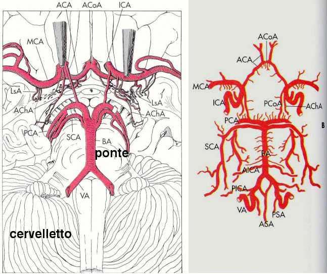 livello della giunzione tra ponte e midollo per formare l arteria basilare (figura 1, 4), che a livello del ponte da origine all arteria cerebellare antero inferiore e all arteria uditiva interna e a