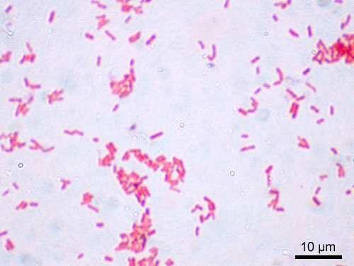 Escherichia coli e Enterococchi intestinali.