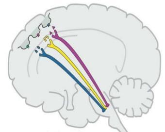 deficit dei neurotrasmettitori monoaminergici, in particolare