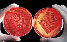 (Cryptosporidiosi e Giardiasi) Antrace IBR e altre malattie respiratorie Paratubercolosi: