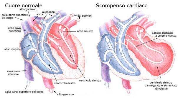 fibrosi, ipertrofia, perdita