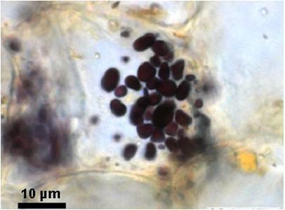 LEUCOPLASTI Sono i plastidi meno differenziati, sono privi di tilacoidi e di qualunque tipo di pigmento.