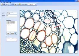 Con un interfaccia utente molto semplice, esso può essere utilizzato per l acquisizione di immagini, la misurazione di linee e la documentazione.