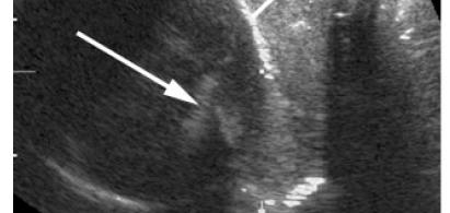 Ultrasound Obstet