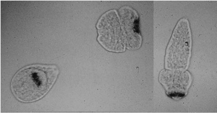 Sabbia idatidea TERAPIA DELL IDATIDOSI Escissione chirurgica (preceduta da NaCl 30% o etanolo 95% iniettati nella cisti)