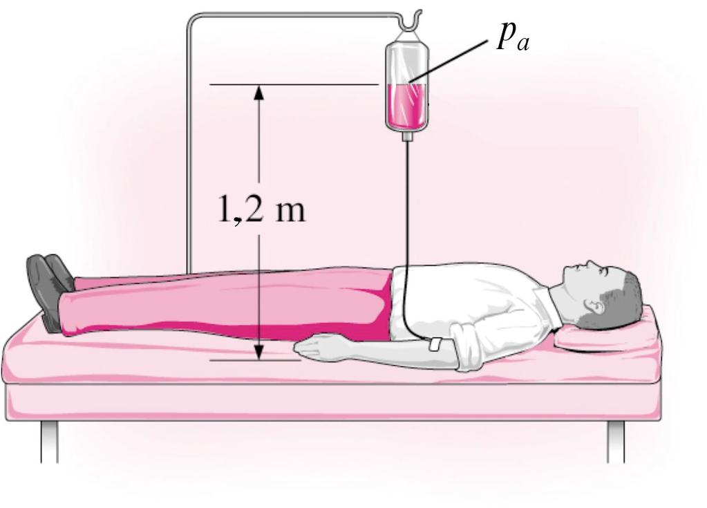 3.99 Un tubo ad U contiene due volumi uguali di acqua e olio di densità 790 kg/m 3.