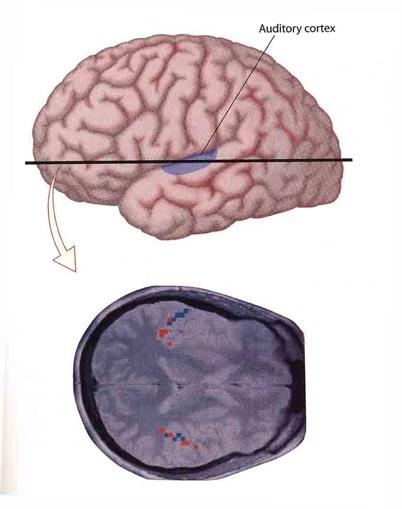 MRI funzionale in una