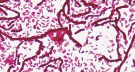 Preparati per Microscopia LA MICROSCOPIA 15900 Batteri e lieviti (12 preparati) Tartaro - saccharomyces cerevisiae (lievito di birra) - coccobacillo - batteri dello yogurt - acetobacter -