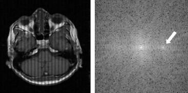 Fourier, si presenta come bande scure che giacciono sopra l immagine.