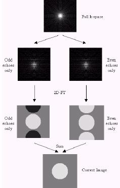Metodo Buonocore Ricostruzione di due immagini dividendo echi pari e disari, applicando uno zero filling. Si ottengono due immagini con artefatto negativo e positivo.