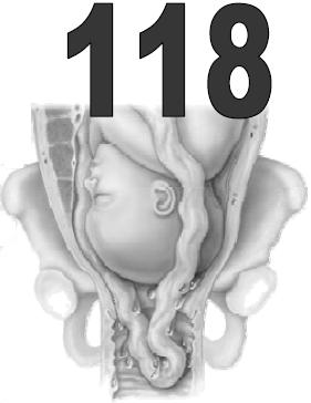 fino al BLOCCO della CIRCOLAZIONE SANGUIGNA verso il feto Spesso associato a parti PODALICI o