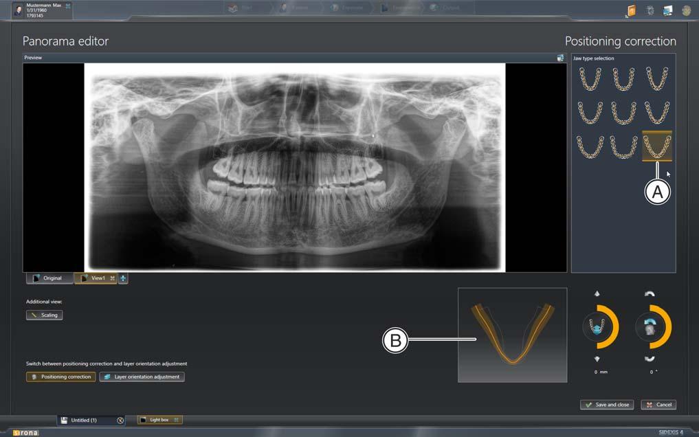 3 Utilizzo dell'editor panoramica Sirona Dental Systems GmbH 3.2 