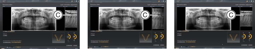 3 Utilizzo dell'editor panoramica Sirona Dental Systems GmbH 3.