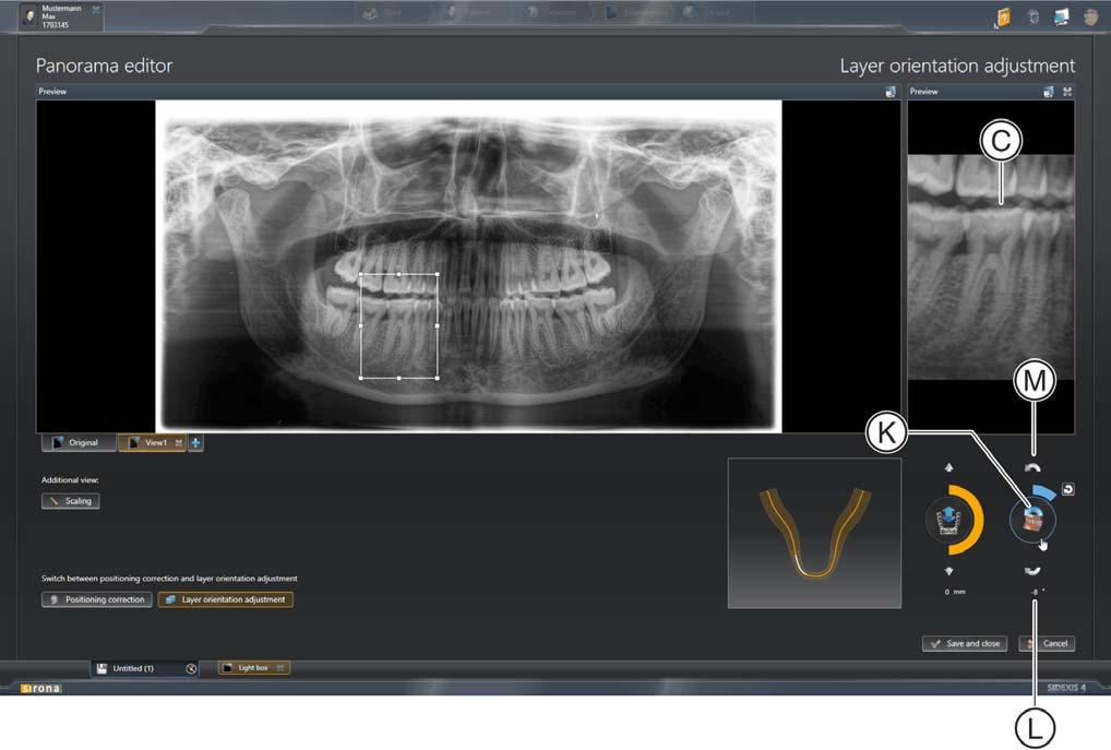 3 Utilizzo dell'editor panoramica Sirona Dental Systems GmbH 3.3 Esecuzione dell'adattamento delle posizioni degli strati Addendum al "Manuale per l'utente SIDEXIS 4" SIDEXIS 4 3.3.2 Inclinazione della posizione dello strato Per l'inclinazione della posizione dello strato esistono diverse possibilità.