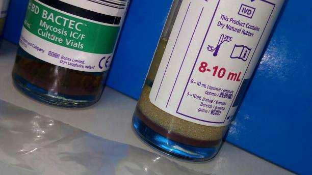 6. Se si effettua da CVC, decontaminare il sito di raccordo, scartare i primi 3-4 ml di sangue utilizzando una provetta per prelievo di sangue, quindi far defluire il sangue come da VP nei flaconi. 7.