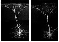 Evidence of Neuronal Atrophy and Loss in Response to Stress: Preclinical Studies