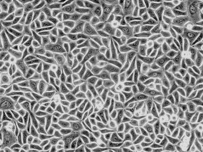 Sono costituiti da cellule morfologicamente simili tra loro con scarsa sostanza intercellulare interposta Derivano dai 3 foglietti embrionali: Ectoderma: Cute e gh. annesse Mesoderma: App.