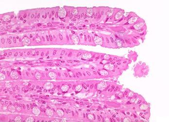 alveoli (scambio) Endotelio