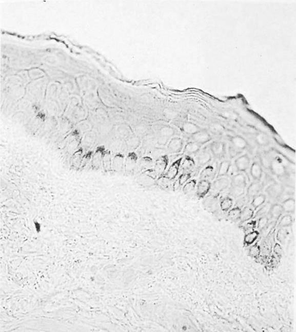 L epidermide tirosina Sezione semifine di cute umana prelevata biopticamente e non colorata.