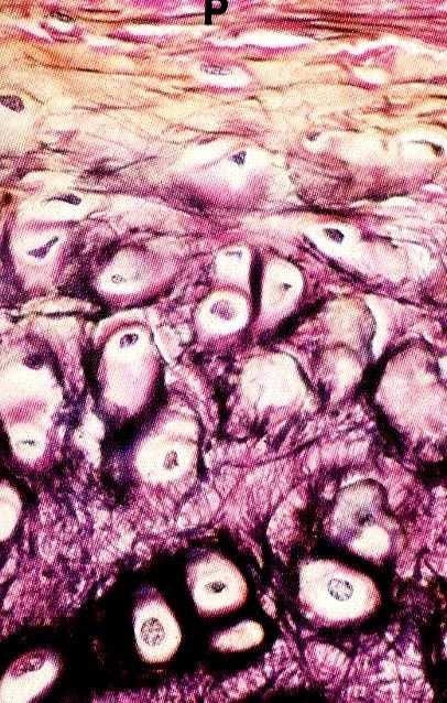 Cartilagine elastica (padiglione auricolare, epiglottide, meato uditivo, laringe) Simile alla jalina.