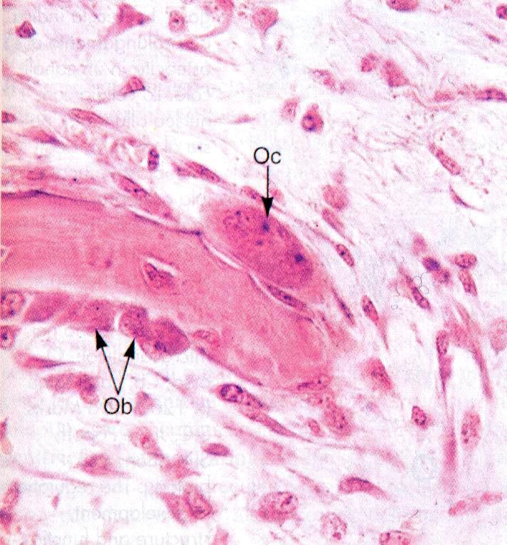-cellule dell osso cellule osteoprogenitrici osteoblasti osteociti osteoclasti -Cellule osteoprogenitrici sono le cellule staminali del t.