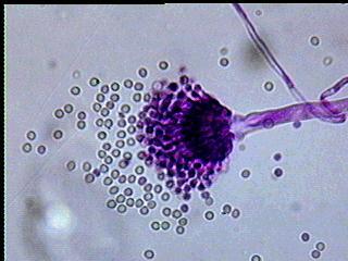 ASPERGILLUS Aspergillus, funghi Ascomiceti, nella forma ricorda un aspersorio.