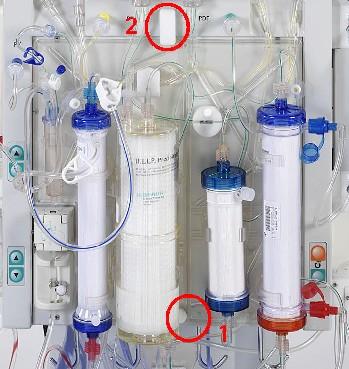 HELP- HEPARIN Induced Extracorporeal Ldl Precipitation Rimozione di: colesterolo LDL